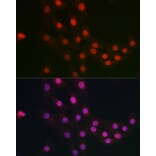 Immunofluorescence - Anti-FANCC Antibody (A8967) - Antibodies.com