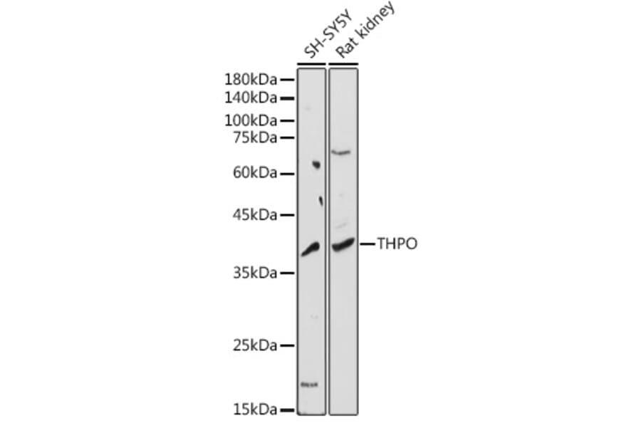 Western Blot - Anti-Thrombopoietin Antibody (A8968) - Antibodies.com