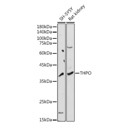 Western Blot - Anti-Thrombopoietin Antibody (A8968) - Antibodies.com