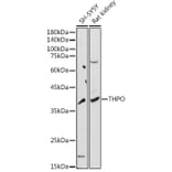 Western Blot - Anti-Thrombopoietin Antibody (A8968) - Antibodies.com