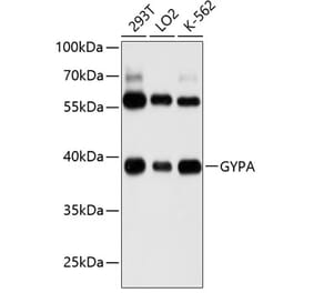 Western Blot - Anti-Glycophorin A Antibody (A8969) - Antibodies.com