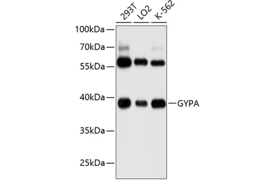 Western Blot - Anti-Glycophorin A Antibody (A8969) - Antibodies.com