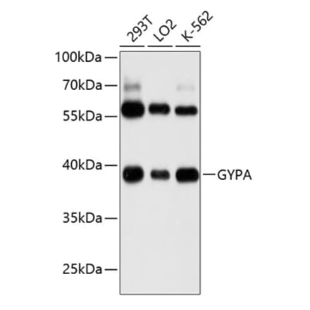 Western Blot - Anti-Glycophorin A Antibody (A8969) - Antibodies.com