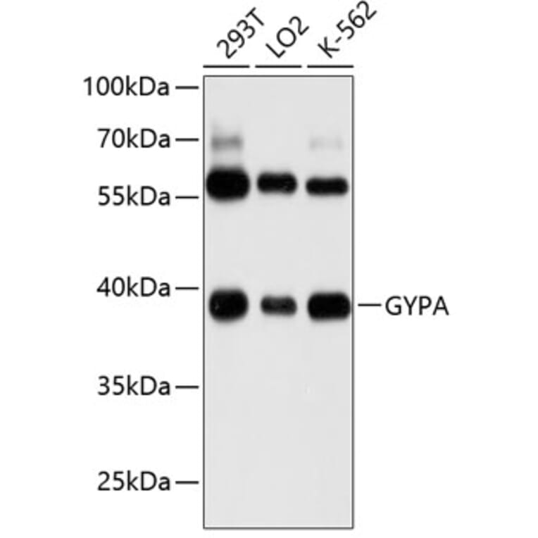 Western Blot - Anti-Glycophorin A Antibody (A8969) - Antibodies.com