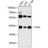 Western Blot - Anti-Glycophorin A Antibody (A8969) - Antibodies.com