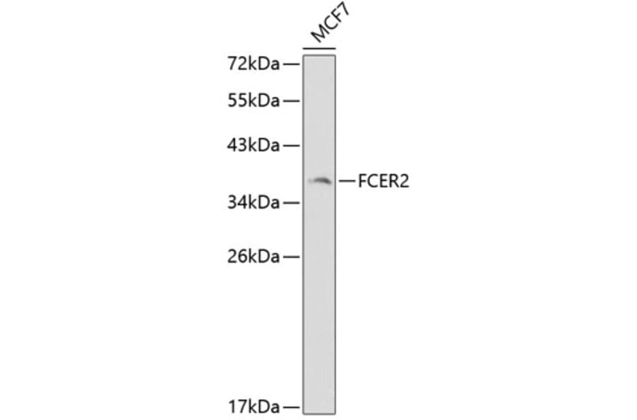 Western Blot - Anti-FCER2 Antibody (A1839) - Antibodies.com