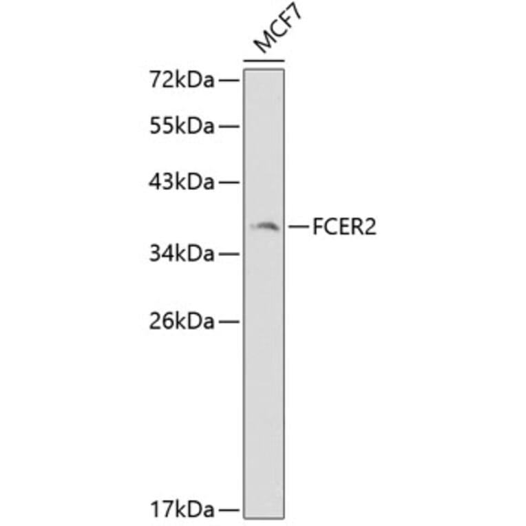 Western Blot - Anti-FCER2 Antibody (A1839) - Antibodies.com