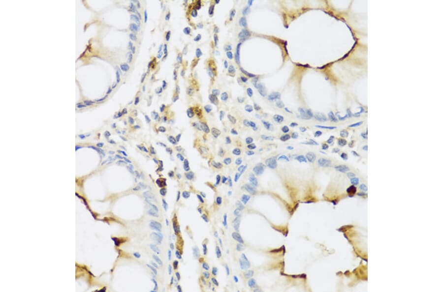 Immunohistochemistry - Anti-Ribonuclease 3/ECP Antibody (A8972) - Antibodies.com