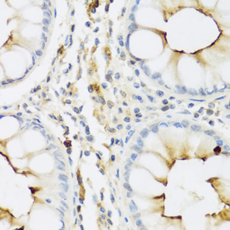 Immunohistochemistry - Anti-Ribonuclease 3/ECP Antibody (A8972) - Antibodies.com