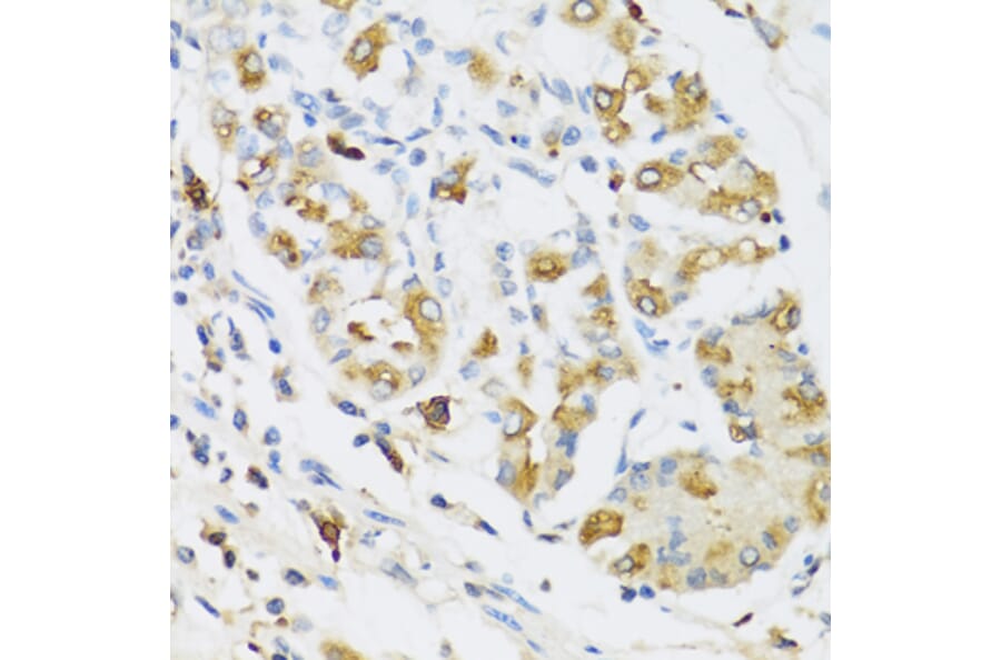 Immunohistochemistry - Anti-Ribonuclease 3/ECP Antibody (A8972) - Antibodies.com
