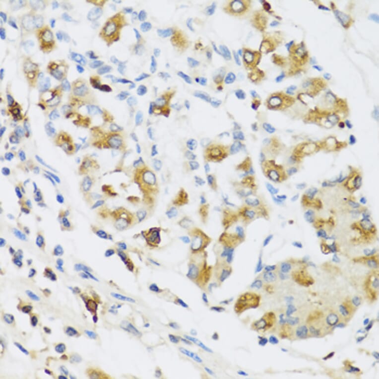 Immunohistochemistry - Anti-Ribonuclease 3/ECP Antibody (A8972) - Antibodies.com