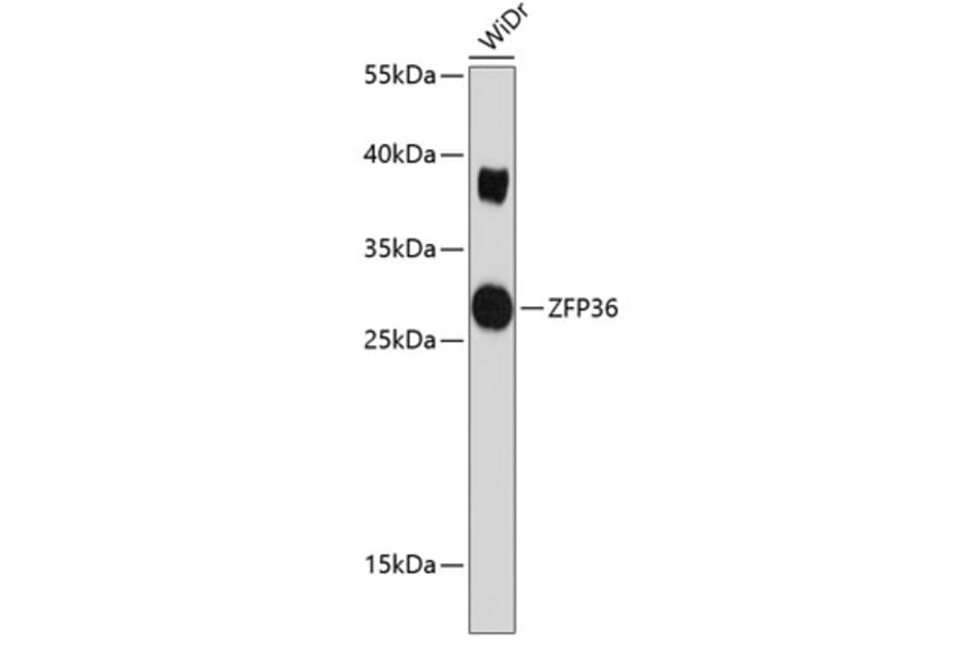 Western Blot - Anti-Tristetraprolin/TTP Antibody (A8974) - Antibodies.com