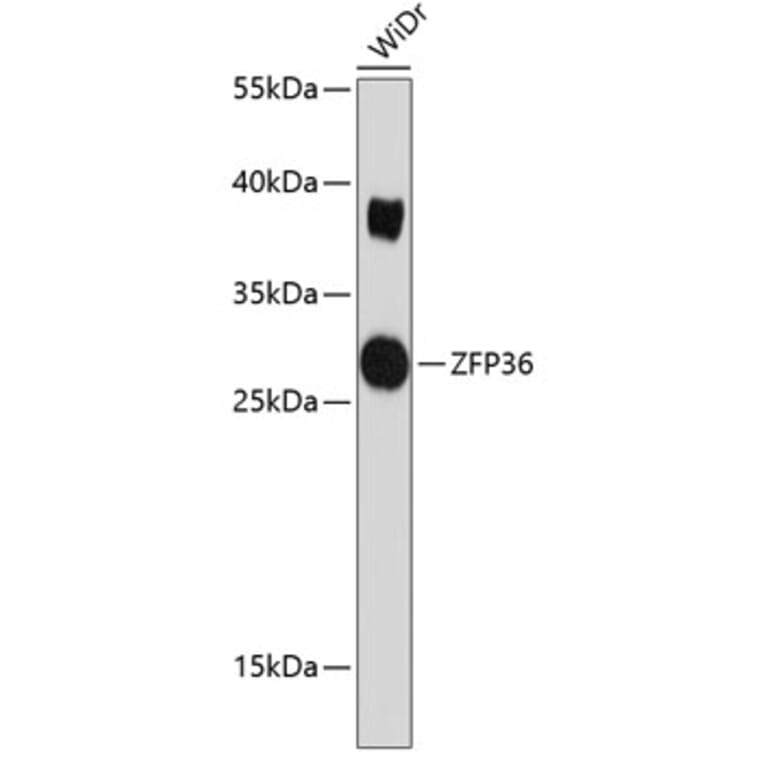 Western Blot - Anti-Tristetraprolin/TTP Antibody (A8974) - Antibodies.com