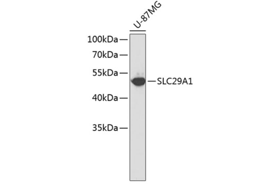 Western Blot - Anti-SLC29A1 Antibody (A1884) - Antibodies.com