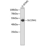 Western Blot - Anti-SLC29A1 Antibody (A1884) - Antibodies.com