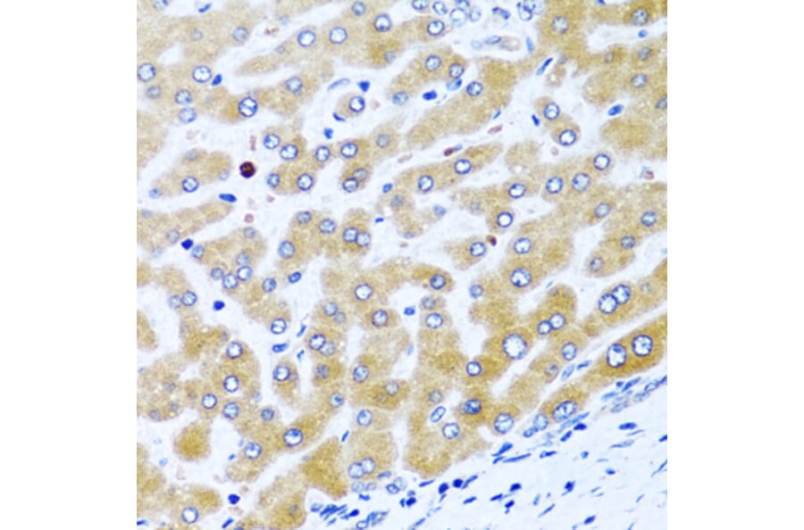 Immunohistochemistry - Anti-CCL21 Antibody (A8977) - Antibodies.com