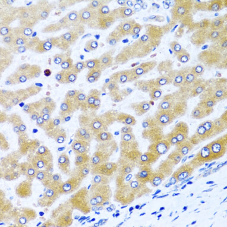 Immunohistochemistry - Anti-CCL21 Antibody (A8977) - Antibodies.com