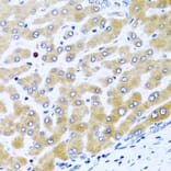 Immunohistochemistry - Anti-CCL21 Antibody (A8977) - Antibodies.com