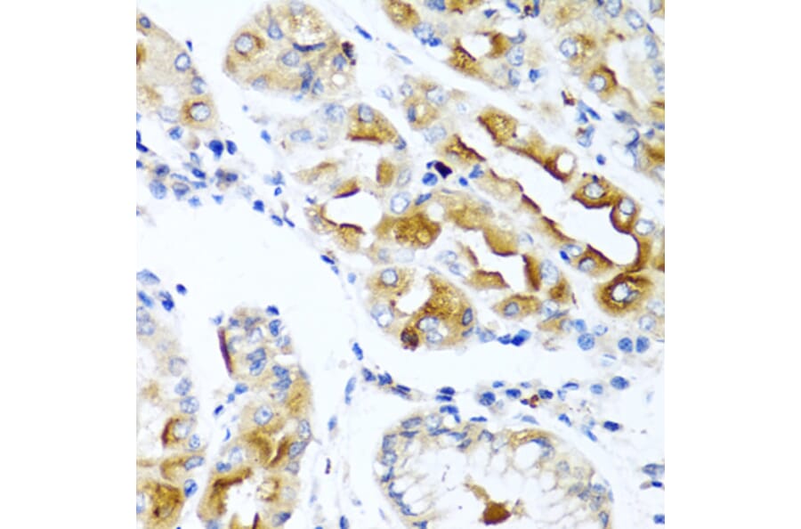 Immunohistochemistry - Anti-CCL21 Antibody (A8977) - Antibodies.com