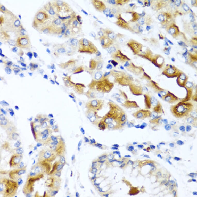 Immunohistochemistry - Anti-CCL21 Antibody (A8977) - Antibodies.com