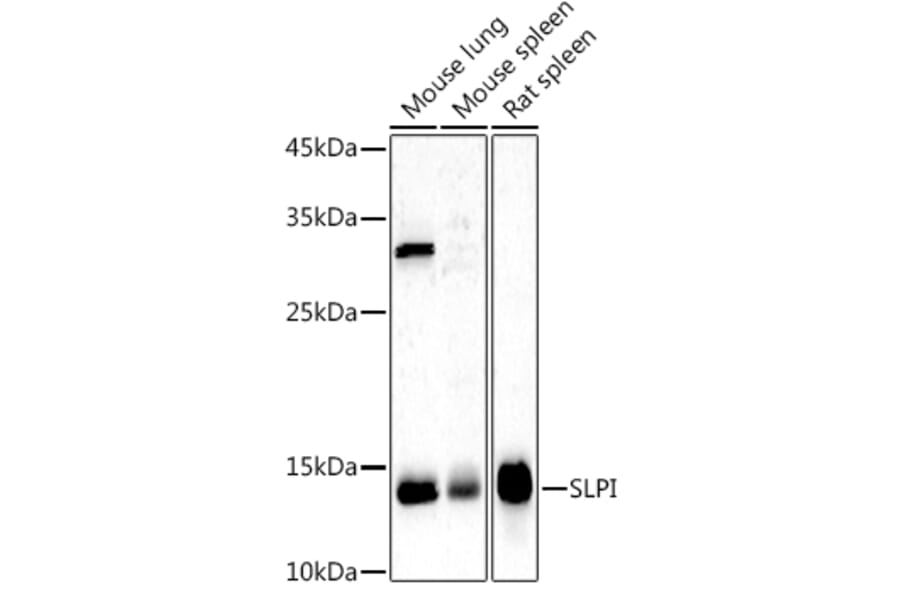 Western Blot - Anti-SLPI Antibody (A8978) - Antibodies.com