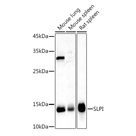 Western Blot - Anti-SLPI Antibody (A8978) - Antibodies.com