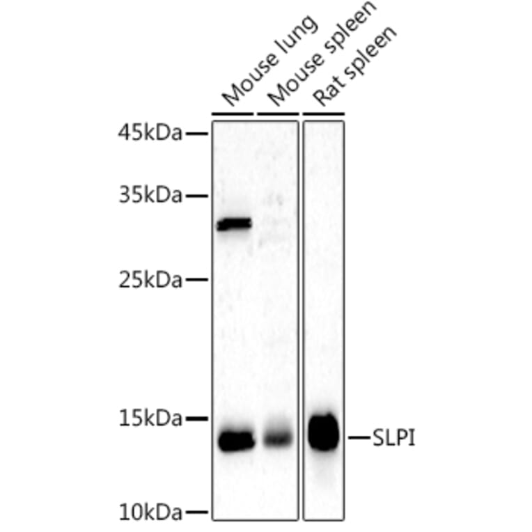 Western Blot - Anti-SLPI Antibody (A8978) - Antibodies.com