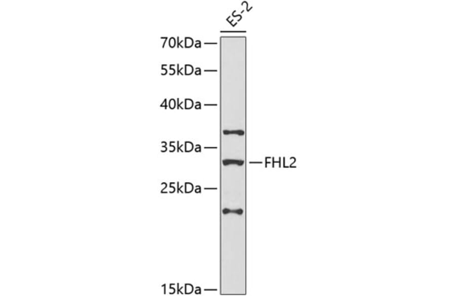Western Blot - Anti-FHL2 Antibody (A1907) - Antibodies.com
