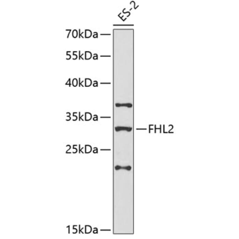 Western Blot - Anti-FHL2 Antibody (A1907) - Antibodies.com