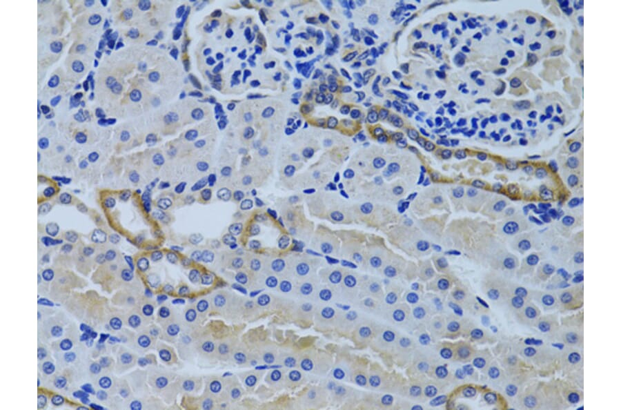 Immunohistochemistry - Anti-FHL2 Antibody (A1907) - Antibodies.com