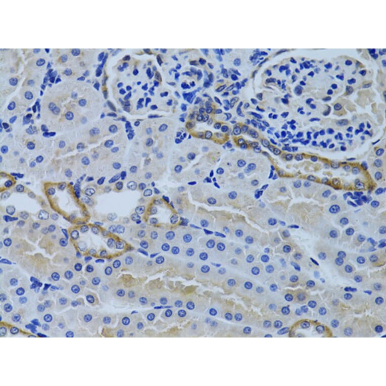Immunohistochemistry - Anti-FHL2 Antibody (A1907) - Antibodies.com