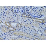 Immunohistochemistry - Anti-FHL2 Antibody (A1907) - Antibodies.com