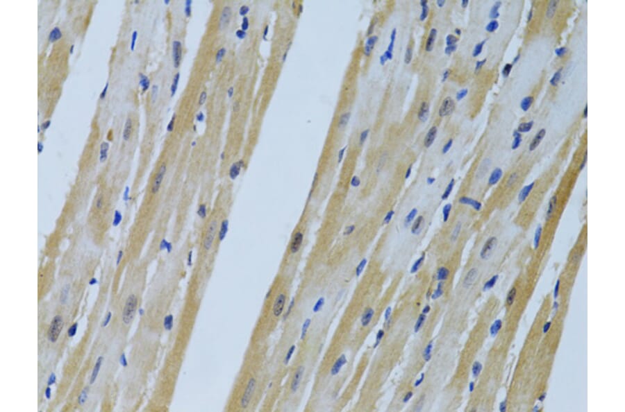 Immunohistochemistry - Anti-FHL2 Antibody (A1907) - Antibodies.com