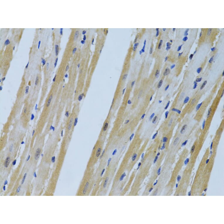 Immunohistochemistry - Anti-FHL2 Antibody (A1907) - Antibodies.com
