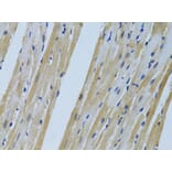 Immunohistochemistry - Anti-FHL2 Antibody (A1907) - Antibodies.com