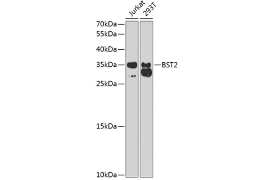Western Blot - Anti-BST2 / Tetherin Antibody (A8980) - Antibodies.com