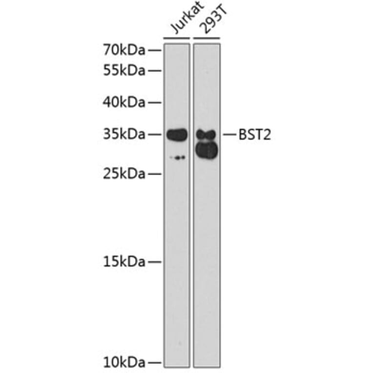 Western Blot - Anti-BST2 / Tetherin Antibody (A8980) - Antibodies.com