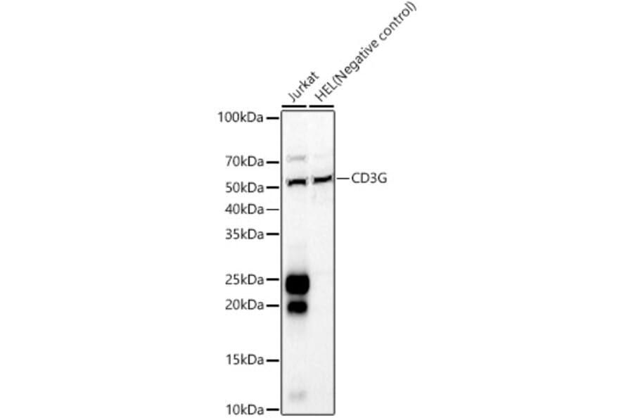 Western Blot - Anti-CD3G Antibody (A8981) - Antibodies.com
