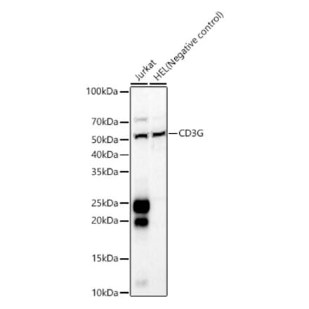 Western Blot - Anti-CD3G Antibody (A8981) - Antibodies.com