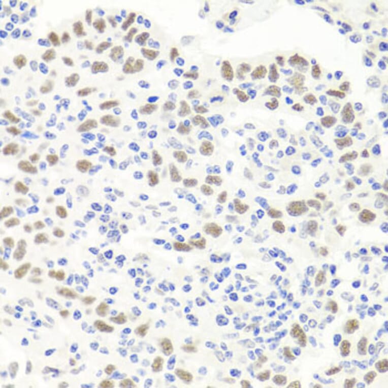 Immunohistochemistry - Anti-Exonuclease 1 Antibody (A8982) - Antibodies.com