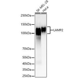 Western Blot - Anti-LAMP2 Antibody (A8983) - Antibodies.com