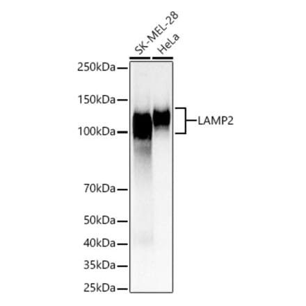 Western Blot - Anti-LAMP2 Antibody (A8983) - Antibodies.com