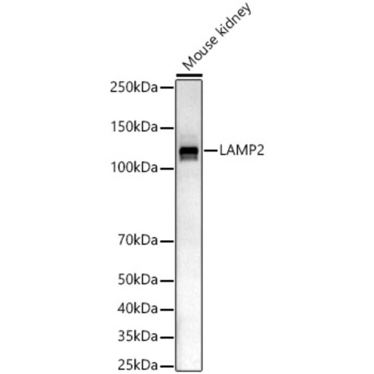 Western Blot - Anti-LAMP2 Antibody (A8983) - Antibodies.com