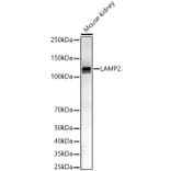 Western Blot - Anti-LAMP2 Antibody (A8983) - Antibodies.com