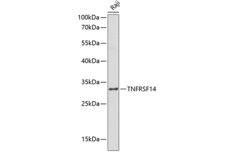 Western Blot - Anti-TNFRSF14/HVEM Antibody (A8984) - Antibodies.com
