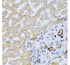 Immunohistochemistry - Anti-CSH1 Antibody (A8985) - Antibodies.com
