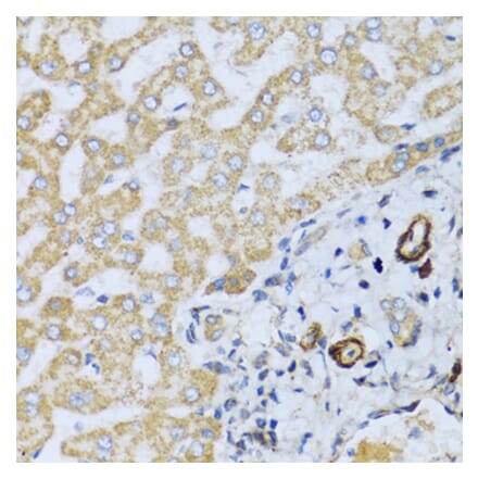 Immunohistochemistry - Anti-CSH1 Antibody (A8985) - Antibodies.com