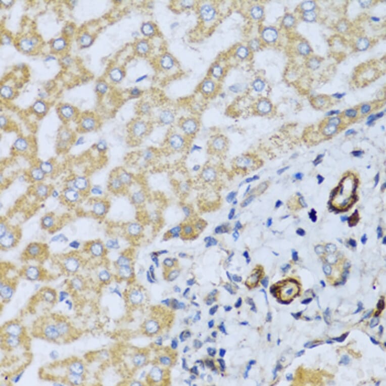 Immunohistochemistry - Anti-CSH1 Antibody (A8985) - Antibodies.com