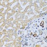 Immunohistochemistry - Anti-CSH1 Antibody (A8985) - Antibodies.com