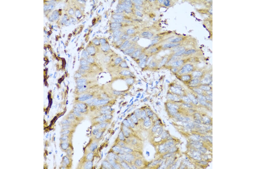 Immunohistochemistry - Anti-CSH1 Antibody (A8985) - Antibodies.com